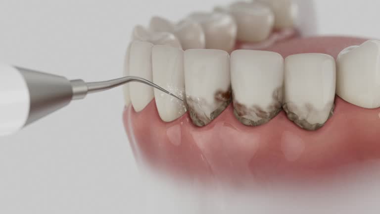Reliable Dental contractor in Lincoln, AL by Smile Center Dentistry
